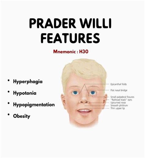 prada willy|prader willi syndrome support.